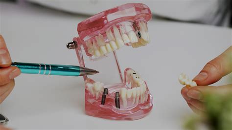 what are the cheapest teeth implants